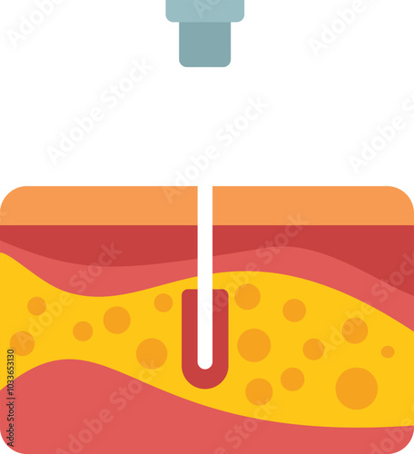 Microneedle patch delivering medication or vaccine through skin layers to bloodstream, medical treatment concept