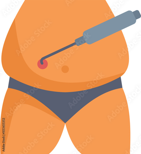 Medical professional removing excess fat from patient's stomach area using cannula