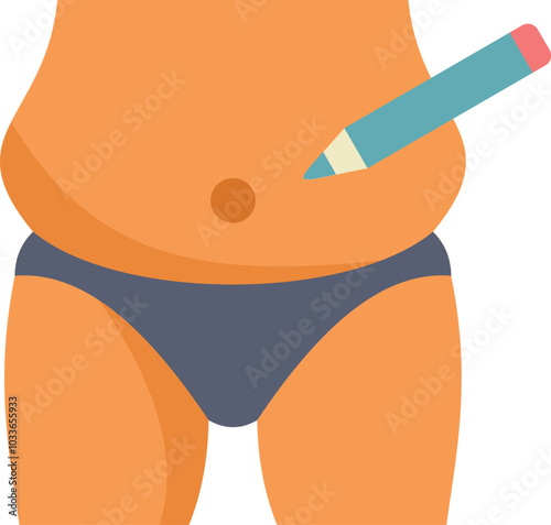 Surgeon is preparing an obese patient for liposuction surgery by marking the area to be treated