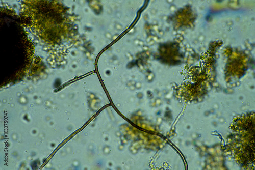 soil fungi storing carbon in the soil. testate amoebae and bacteria cycling nutrients. regenerative agriculture sustainable practices growing healthy food on farms and in crops photo