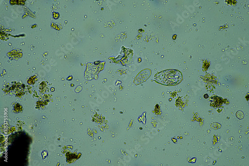 soil fungi storing carbon in the soil. testate amoebae and bacteria cycling nutrients. regenerative agriculture sustainable practices growing healthy food on farms and in crops photo