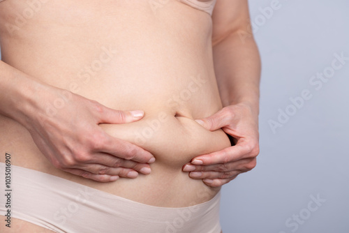 Close-up of a woman's belly from the side, clutching with her hands the excess fat on her abdomen. Concept of weight, overweight, fat and woman