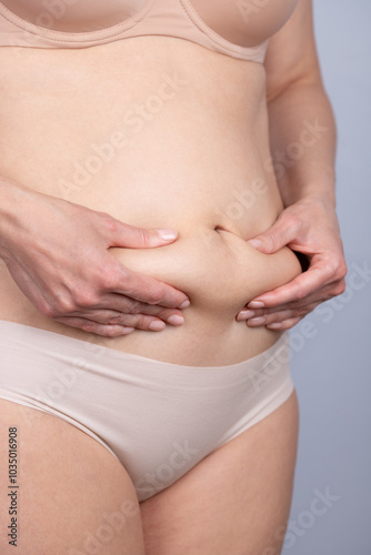 Wallpaper Mural Woman in her underwear on profile, clutching with her hands the excess fat on her abdomen. Concept of weight, diet, fat and woman Torontodigital.ca