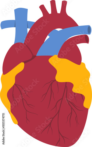 Heart disease illustration. Cardiovascular disease illustration.