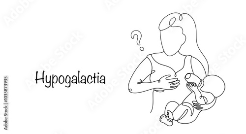 Hypogalactia
