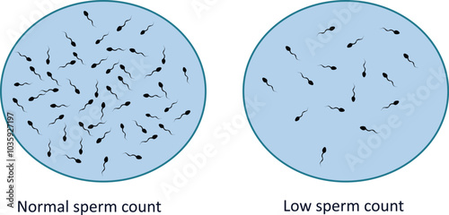 Low sperm count and normal sperm count vector illustration