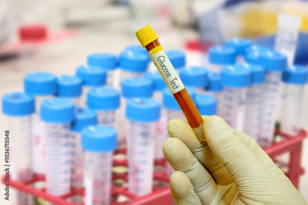 Blood Sample Collection in a Test Tube for Medical Testing and Research - Glucose Test - Laboratory Gloved Hand Holding a Test Tube in a Medical Research Setting Blood Sample Collection in a Test Tube for Medical Testing and Research - Glucose Test - Laboratory Gloved Hand Holding a Test Tube in a Medical Research Setting