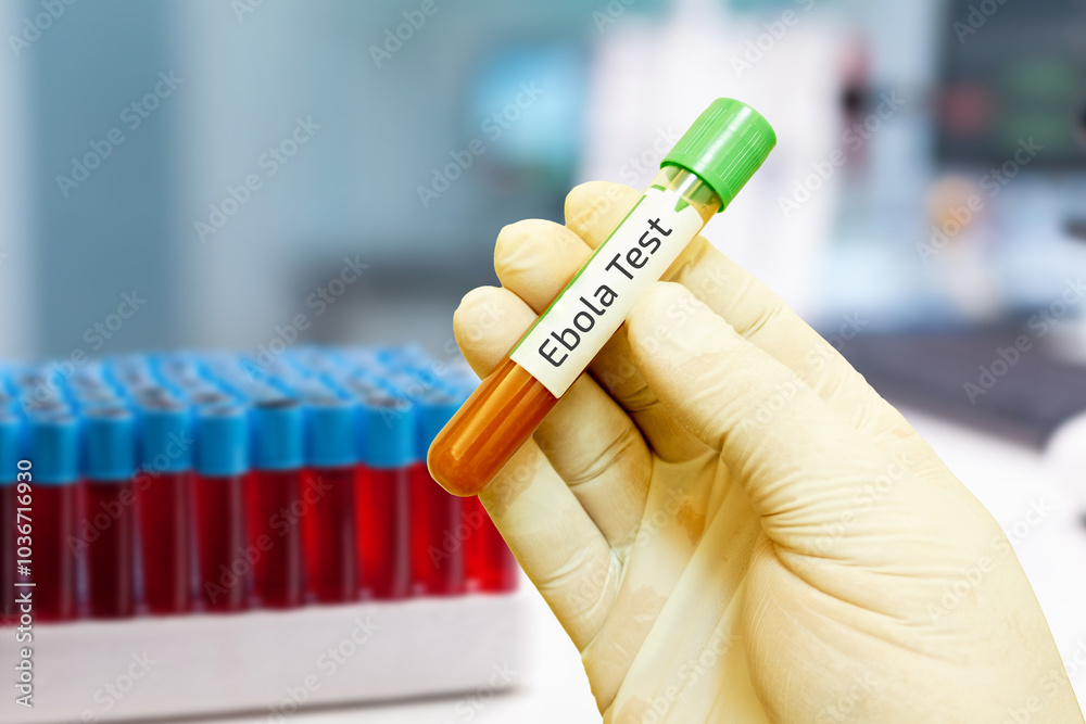 Blood Sample Collection in a Test Tube for Medical Testing and Research - Ebola Test - Laboratory Gloved Hand Holding a Test Tube in a Medical Research Setting Blood Sample Collection in a Test Tube for Medical Testing and Research - Ebola Test - Laboratory Gloved Hand Holding a Test Tube in a Medical Research Setting
