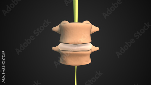 фотографія Vertebral Slippage Resulting in Spondylolisthesis Symptoms