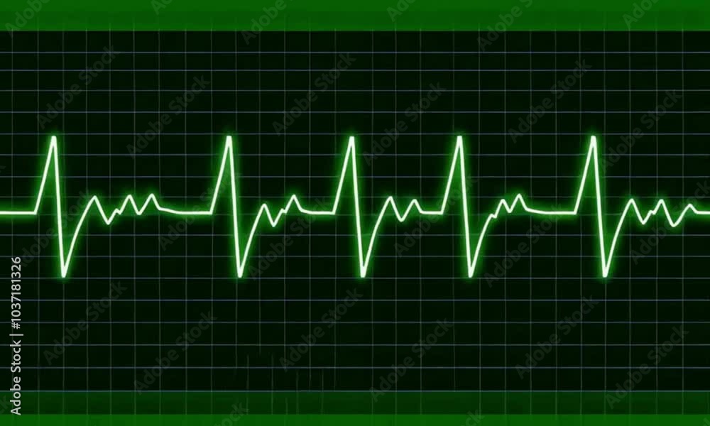 heart beat on monitor