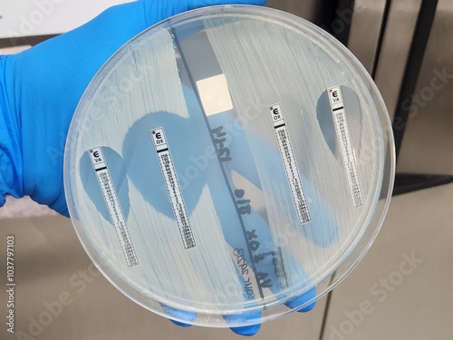 Methicillin sensitive and resistant staphylococcal isolates - E-test photo