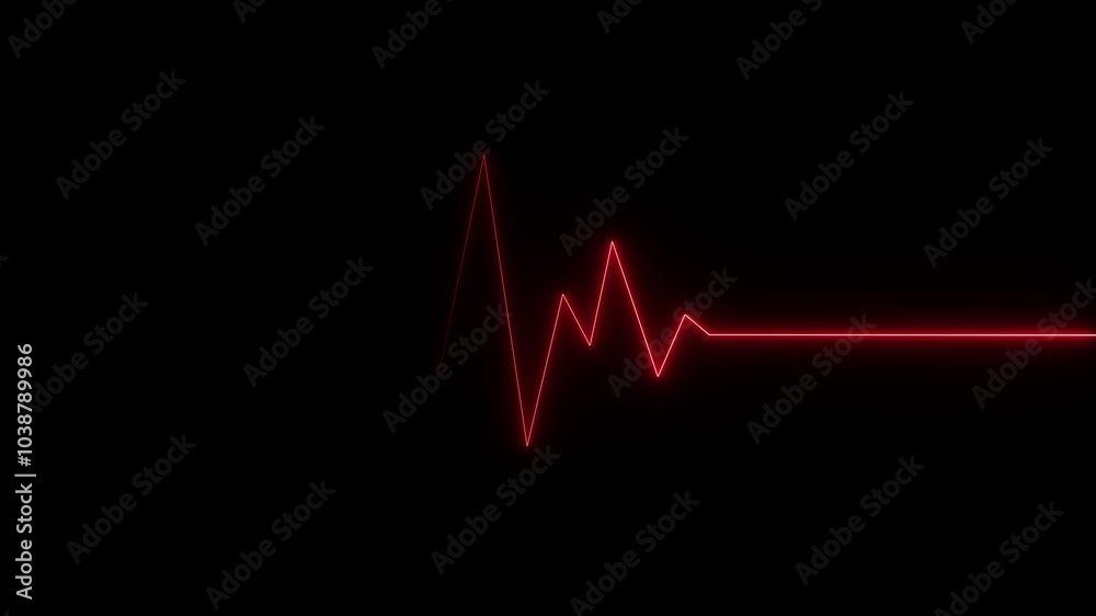 Heart rate monitor in hospital theater. Medical vital signs monitor instrument in a hospital on anesthesia surgery monitor. patient stable after heart surgery