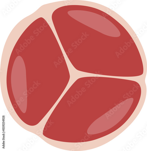 Aortic Stenosis