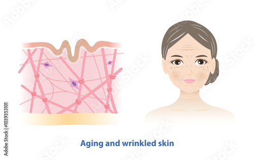 The old woman with aging and wrinkled skin vector on white background. Cross section of depletion of collagen, elastin fibers and fibroblasts in the dermis layer. Skin care and beauty concept.