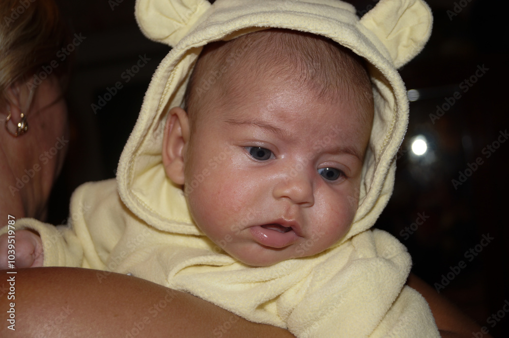 A newborn or infant or toddler or small child with a rash or redness on the face, wearing a hood with ears on the head, in the arms of a woman, looking down, with the mouth open. A newborn or infant or toddler or small child with a rash or redness on the face, wearing a hood with ears on the head, in the arms of a woman, looking down, with the mouth open.