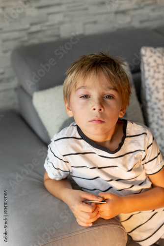 Preschool child, sweet boy with alergic reaction and swollen eye from insect bite photo