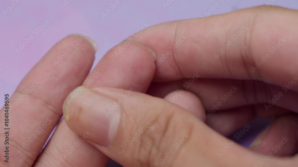 Poking their finger to obtain a blood sample Poking their finger to obtain a blood sample