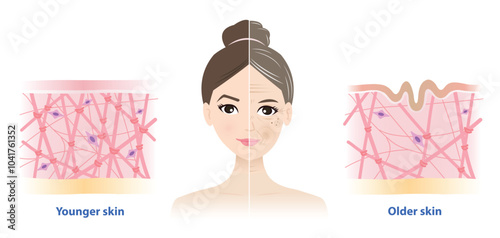 The difference between young and aging skin on woman face vector illustration. Aging process comparison. Cross section of high and low density of collagen, elastin fibers and fibroblasts in dermis.