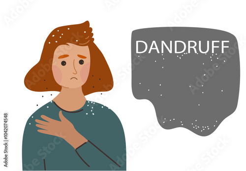 Young woman with dandruff problem.Health medicine, trichology, dermatology concept. Vector hand drawn flat cartoon illustration.