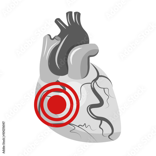 Infarct. Heart pain on a white background
