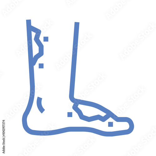 diabetic foot