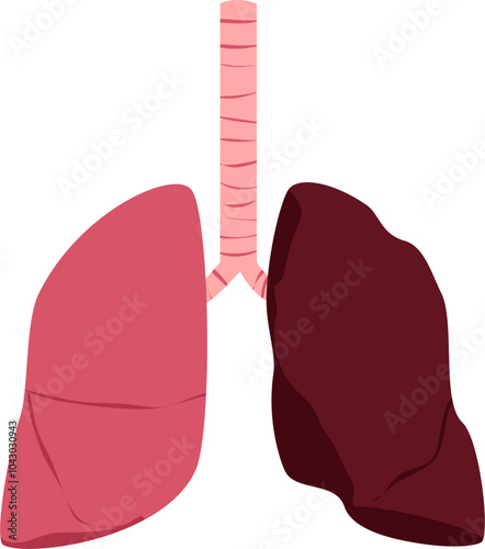 Lung disease. Respiratory disease illustration.