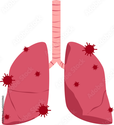 Lung disease. Respiratory disease illustration.