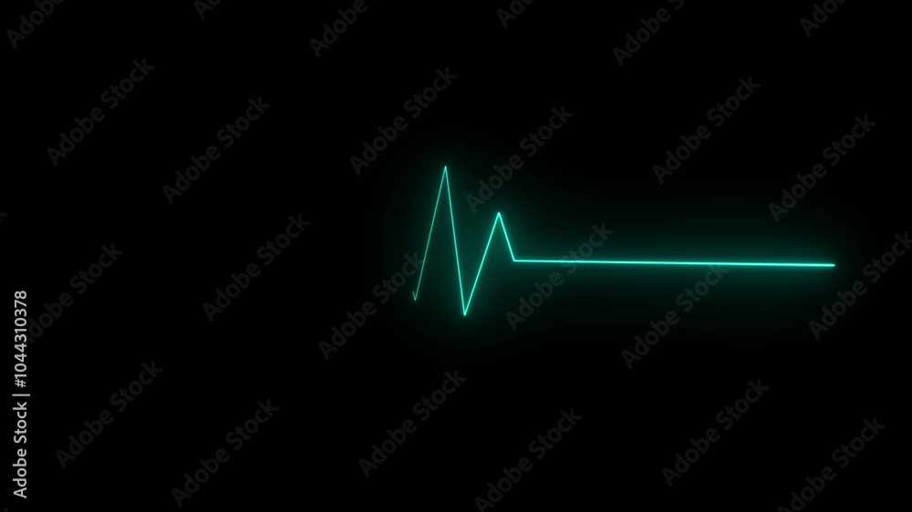 Heart rate monitors electrocardiogram EKG or ECG looping background Heart rate monitors electrocardiogram EKG or ECG looping background