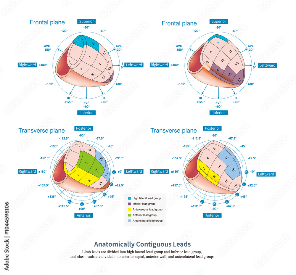 Póster On the electrocardiogram, the range of the myocardium is ...