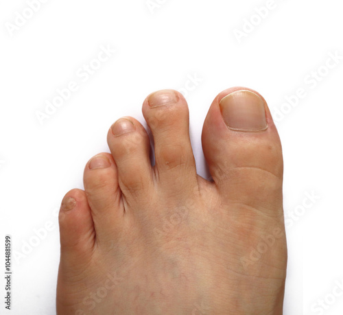 feet of a person