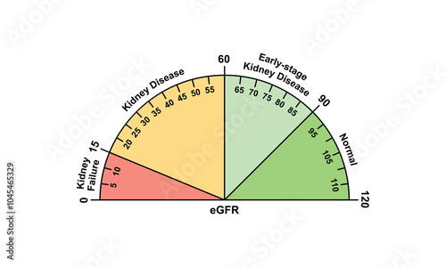 Chronic Kidney Disease (CKD) Stages Scientific Design. Vector Illustration.
