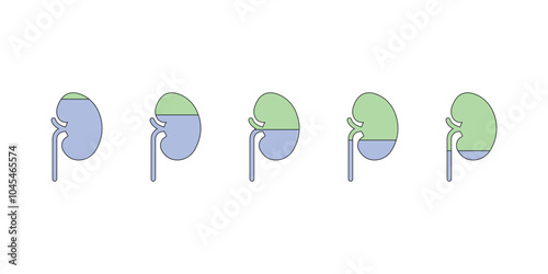 Chronic Kidney Disease (CKD) Stages Scientific Design. Vector Illustration.
