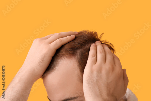 Young redhead man with hair loss problem on yellow background, closeup