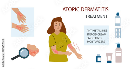 caucasian woman suffers from atopic dermatitis. Neurodermatitis symptoms and reasons infographic. Human skin infection dermatitis diagnosis. Vector doodle hand drawn flat illustration	