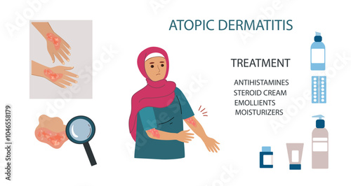 Muslim woman suffers from atopic dermatitis. Neurodermatitis symptoms and reasons infographic. Human skin infection dermatitis diagnosis. Vector doodle hand drawn flat illustration	