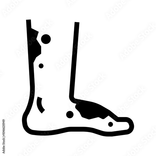 diabetic foot