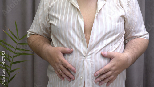 Man Showing Shirt Doesn’t Fit Over Stomach – Concept of Overweight and Obesity