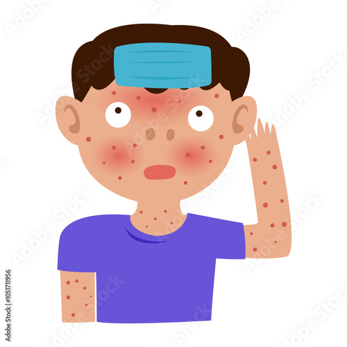 mosquito carrier of dengue fever disease. mosquito bite with allergy rash