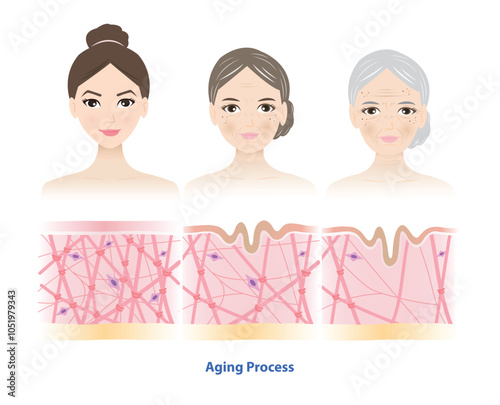 Aging process comparison with 3 generation women face vector illustration. Cross section of high density, depletion and low density of collagen, elastin fibers and fibroblasts in the dermis.