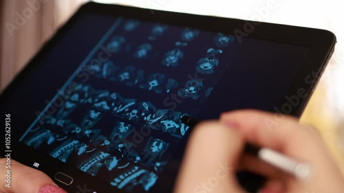 A doctor examines a computed tomography scan of the thyroid gland on a tablet. Online consultation with a doctor.