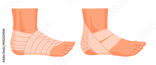 Bandaged human feet. Injured ankles, damaged legs parts, emergency treatment for sprains and bones fractures flat vector illustration set. Physical injury bandages