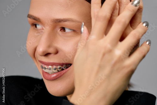 European young woman with clear skin wears braces to correct her bite photo