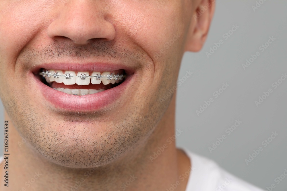 Smiling man with dental braces on grey background, closeup Smiling man with dental braces on grey background, closeup