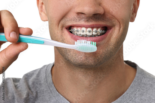 Man with dental braces cleaning teeth on white background, closeup