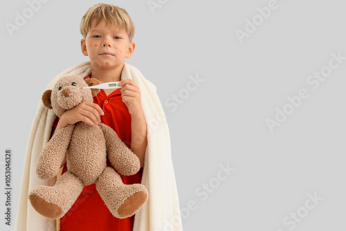 Little boy ill with chicken...
