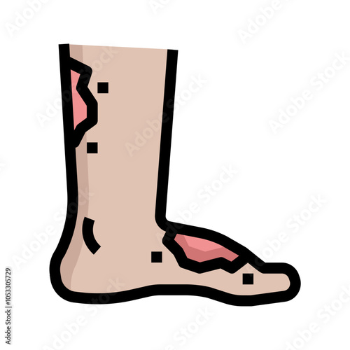 diabetic foot