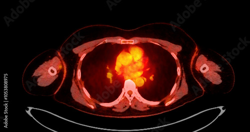 PET scan image displaying whole-body metabolic activity in a side profile view. Suitable for medical education, diagnostics, and research in cellular function.