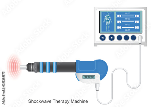 Extracorporeal shock wave therapy (ESWT).