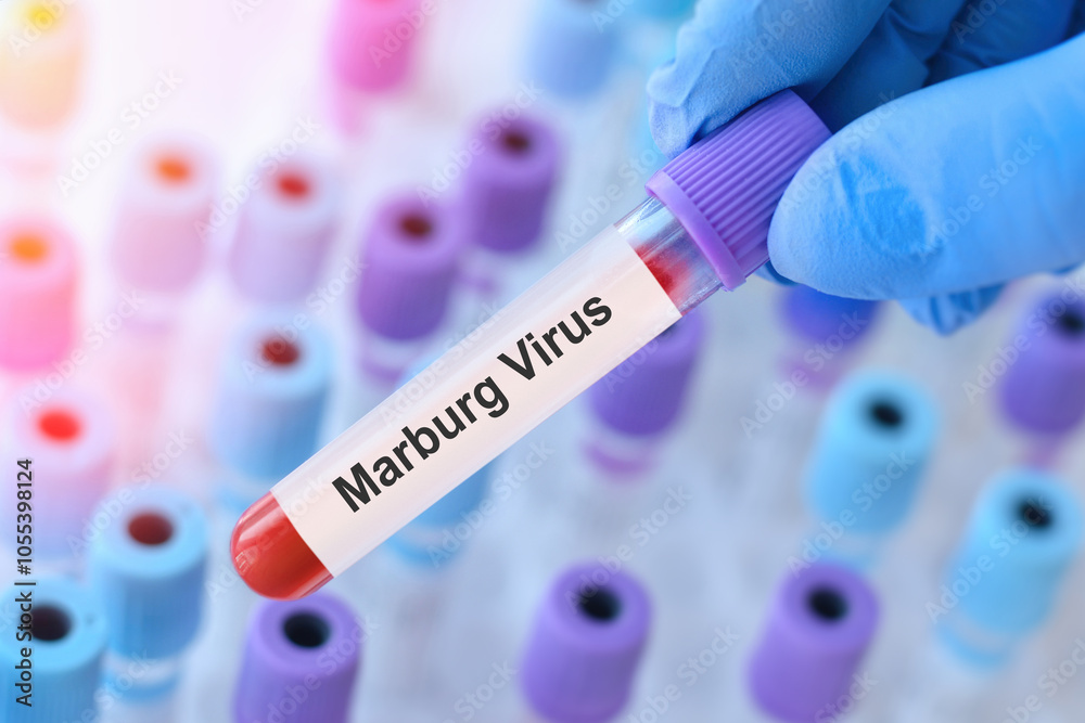 Obraz premium Doctor holding a test blood sample tube with Marburg virus test on the background of medical test tubes with analyzes.