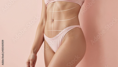 Proportions and Symmetry in Tummy Tuck Surgery – Body Contour Transformation